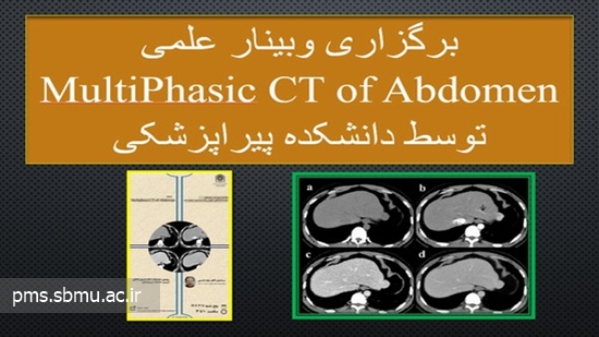 برگزاری وبینار علمی MultiPhasic CT of Abdomen  توسط دانشکده پیراپزشکی 